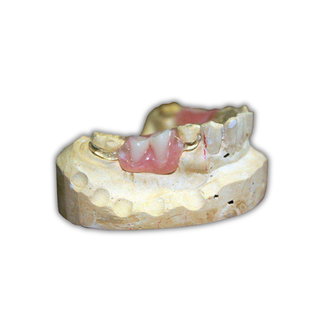 ITSOCLEAR CLASPS